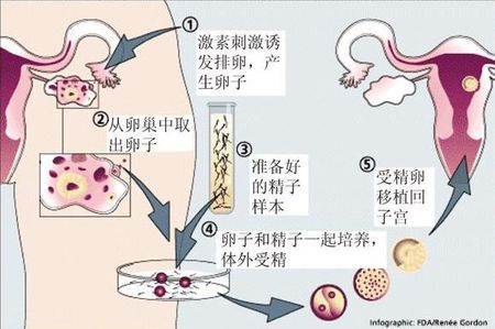 代生选性别供卵代生医院